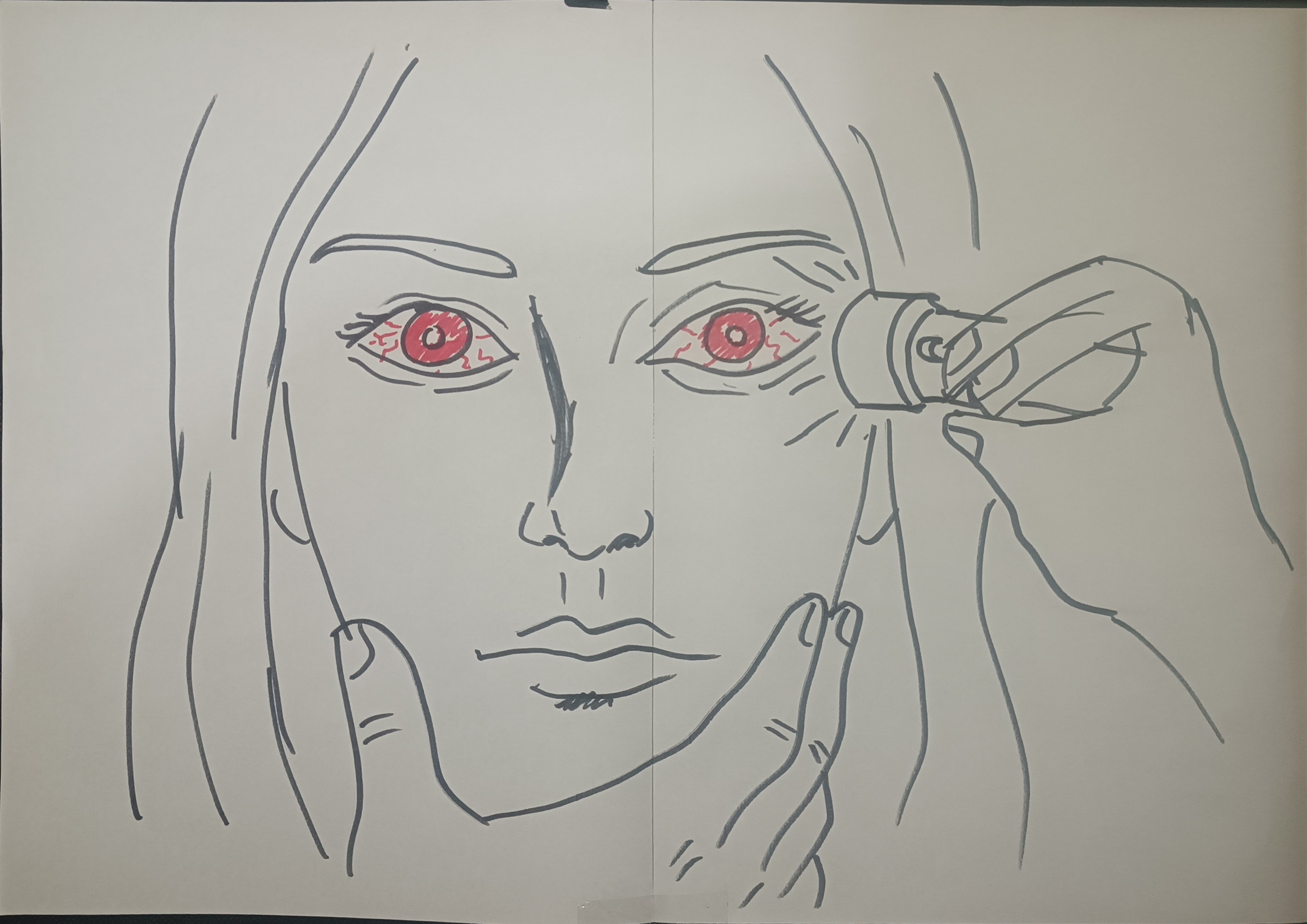Paciente 2 - Ojos rojos